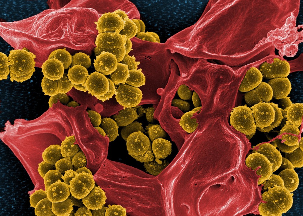 bacteria-808158_1920